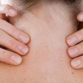 How long is chiropractic treatment for whiplash?